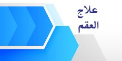 علاج العقم